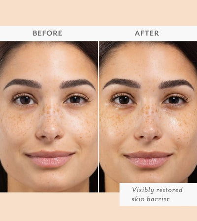 Patchology Skin Remedy Barrier-Boosting Sheet Mask, 1 ct