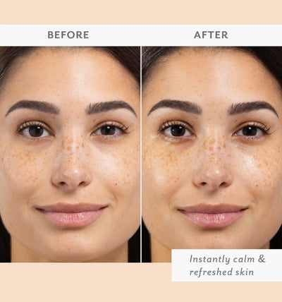 Patchology Skin Remedy Calm & Protect Mist, 2.7 fl oz